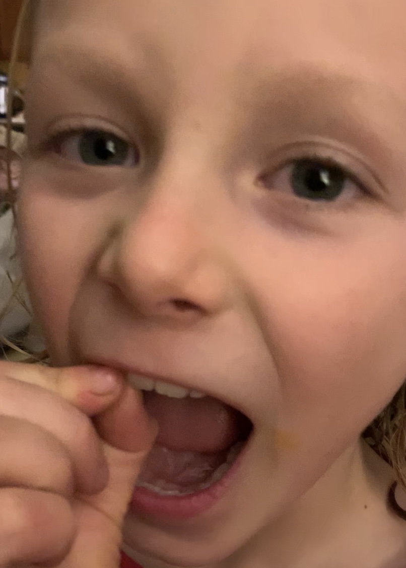 We’ve got a wiggler